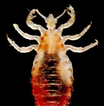 Вошь человеческая