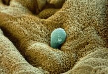 Амеба дизентерийная. Описание опасного паразита