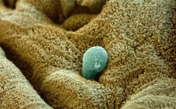 Амеба дизентерийная. Описание опасного паразита