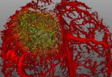 Чудеса микромира: 27 фото – победителей «Nikon Small World 2015»